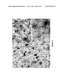 EXTRACELLULAR MATRIX PROTEINS FROM HAEMOPHILUS INFLUENZAE BIOFILMS:     TARGETS FOR THERAPEUTIC OR DIAGNOSTIC USE diagram and image