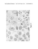 EXTRACELLULAR MATRIX PROTEINS FROM HAEMOPHILUS INFLUENZAE BIOFILMS:     TARGETS FOR THERAPEUTIC OR DIAGNOSTIC USE diagram and image