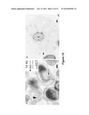 EXTRACELLULAR MATRIX PROTEINS FROM HAEMOPHILUS INFLUENZAE BIOFILMS:     TARGETS FOR THERAPEUTIC OR DIAGNOSTIC USE diagram and image