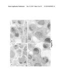 EXTRACELLULAR MATRIX PROTEINS FROM HAEMOPHILUS INFLUENZAE BIOFILMS:     TARGETS FOR THERAPEUTIC OR DIAGNOSTIC USE diagram and image