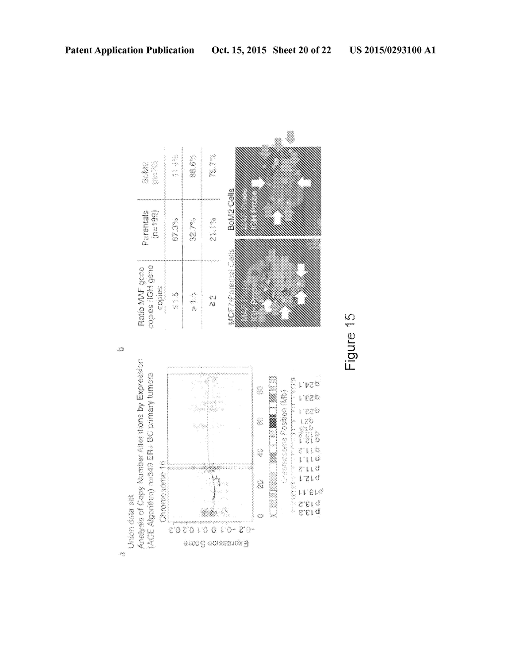 METHOD FOR THE PROGNOSIS AND TREATMENT OF CANCER METASTASIS - diagram, schematic, and image 21