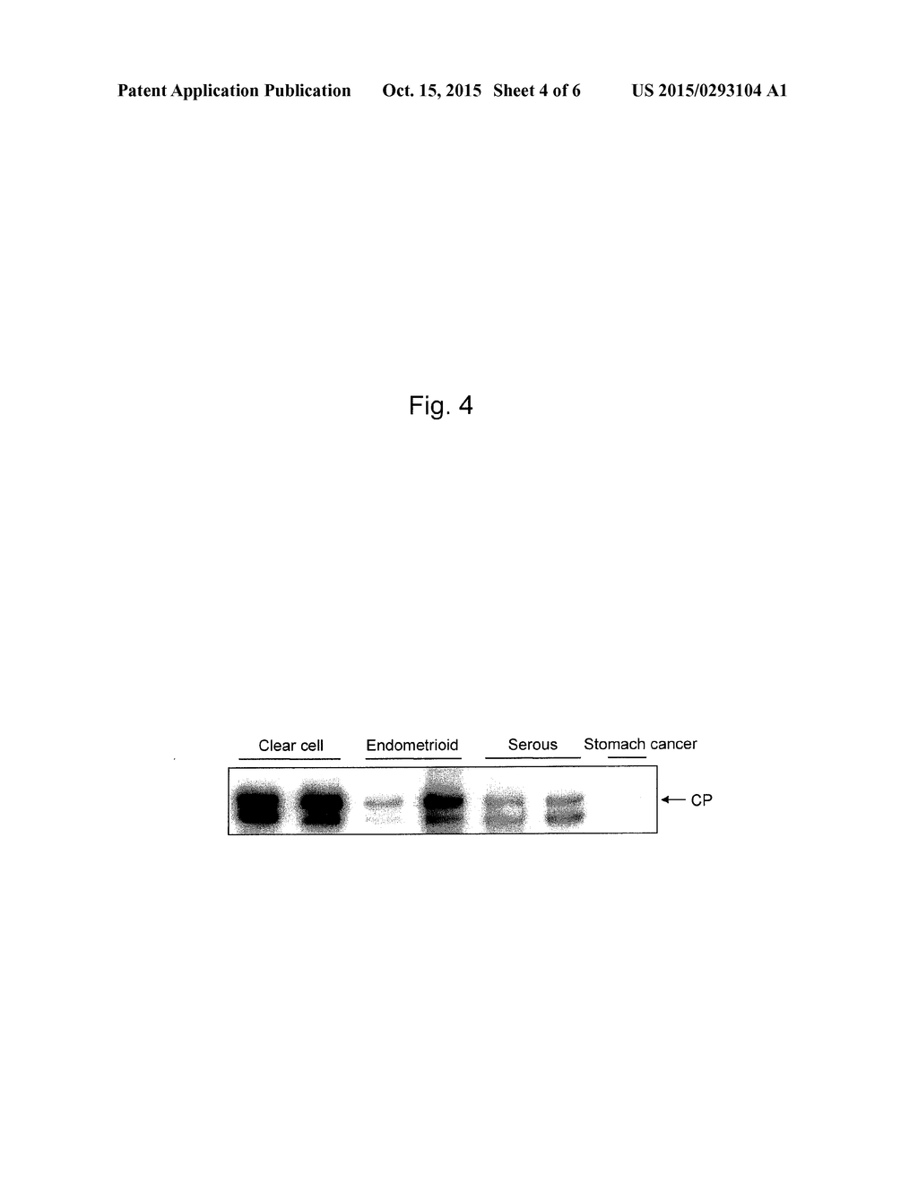 EPITHELIAL OVARIAN CANCER DIFFERENTIATION MARKER - diagram, schematic, and image 05