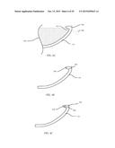 CASE FOR AN ELECTRONIC DEVICE AND MANUFACTURING METHODS FORMAKING A CASE diagram and image