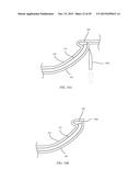 CASE FOR AN ELECTRONIC DEVICE AND MANUFACTURING METHODS FORMAKING A CASE diagram and image