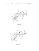 CASE FOR AN ELECTRONIC DEVICE AND MANUFACTURING METHODS FORMAKING A CASE diagram and image