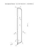 CASE FOR AN ELECTRONIC DEVICE AND MANUFACTURING METHODS FORMAKING A CASE diagram and image