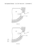 CASE FOR AN ELECTRONIC DEVICE AND MANUFACTURING METHODS FORMAKING A CASE diagram and image