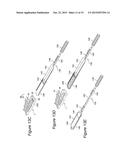 TOOLS AND INSTRUMENTS FOR USE WITH IMPLANTABLE ENCSAPSULATION DEVICES diagram and image