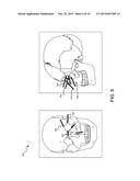 Methods And Systems For Selecting Surgical Approaches diagram and image