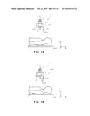 SURGICAL VISUALIZATION SYSTEMS diagram and image