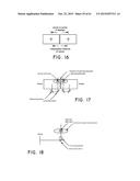 SURGICAL VISUALIZATION SYSTEMS diagram and image