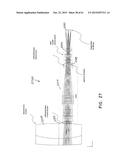 SURGICAL VISUALIZATION SYSTEMS diagram and image