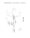 SURGICAL VISUALIZATION SYSTEMS diagram and image