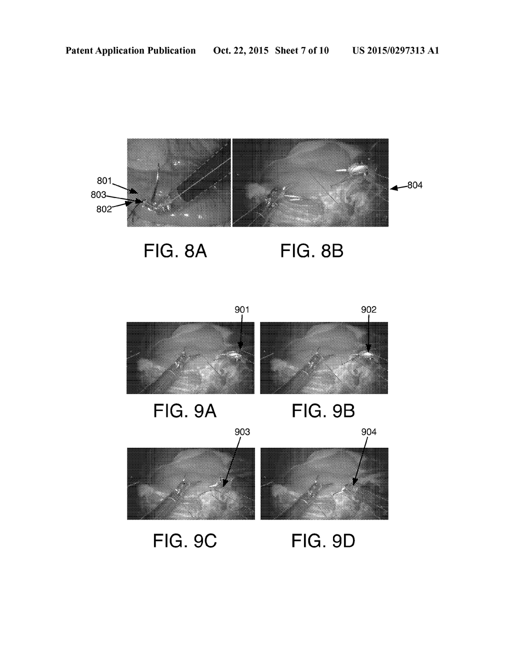 MARKERLESS TRACKING OF ROBOTIC SURGICAL TOOLS - diagram, schematic, and image 08