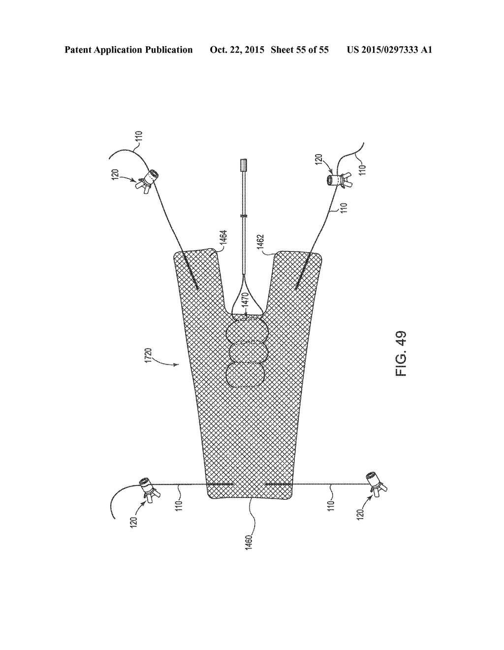 INCONTINENCE TREATMENT DEVICE INCLUDING A SYSTEM OF ANCHORS - diagram, schematic, and image 56