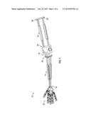 Prosthetic Limb diagram and image