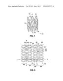 RADIALLY EXPANDABLE POLYMER PROSTHESIS AND METHOD OF MAKING SAME diagram and image