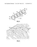 RADIALLY EXPANDABLE POLYMER PROSTHESIS AND METHOD OF MAKING SAME diagram and image