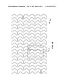 RADIALLY EXPANDABLE POLYMER PROSTHESIS AND METHOD OF MAKING SAME diagram and image