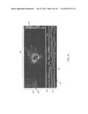 METHOD AND APPARATUS FOR AUTOMATED DETERMINATION OF A LUMEN CONTOUR OF A     STENTED BLOOD VESSEL diagram and image