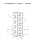 Uniformly Expandable Stent diagram and image