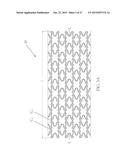 Uniformly Expandable Stent diagram and image