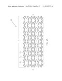 Uniformly Expandable Stent diagram and image