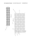 Uniformly Expandable Stent diagram and image