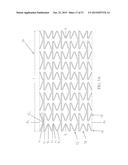 Uniformly Expandable Stent diagram and image