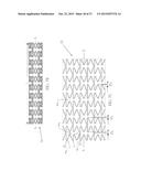 Uniformly Expandable Stent diagram and image