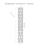 Uniformly Expandable Stent diagram and image