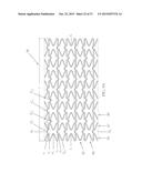 Uniformly Expandable Stent diagram and image