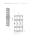 Uniformly Expandable Stent diagram and image