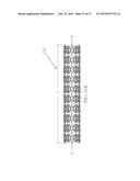 Uniformly Expandable Stent diagram and image