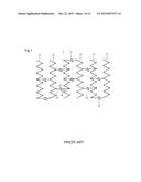 STENT diagram and image