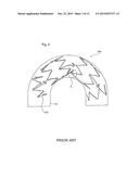 STENT diagram and image