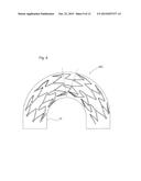 STENT diagram and image