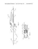 Stent Delivery System diagram and image