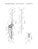 Stent Delivery System diagram and image