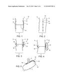 DISRUPTING ELECTRICAL ACTIVITY IN THE STOMACH diagram and image