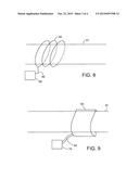 DISRUPTING ELECTRICAL ACTIVITY IN THE STOMACH diagram and image