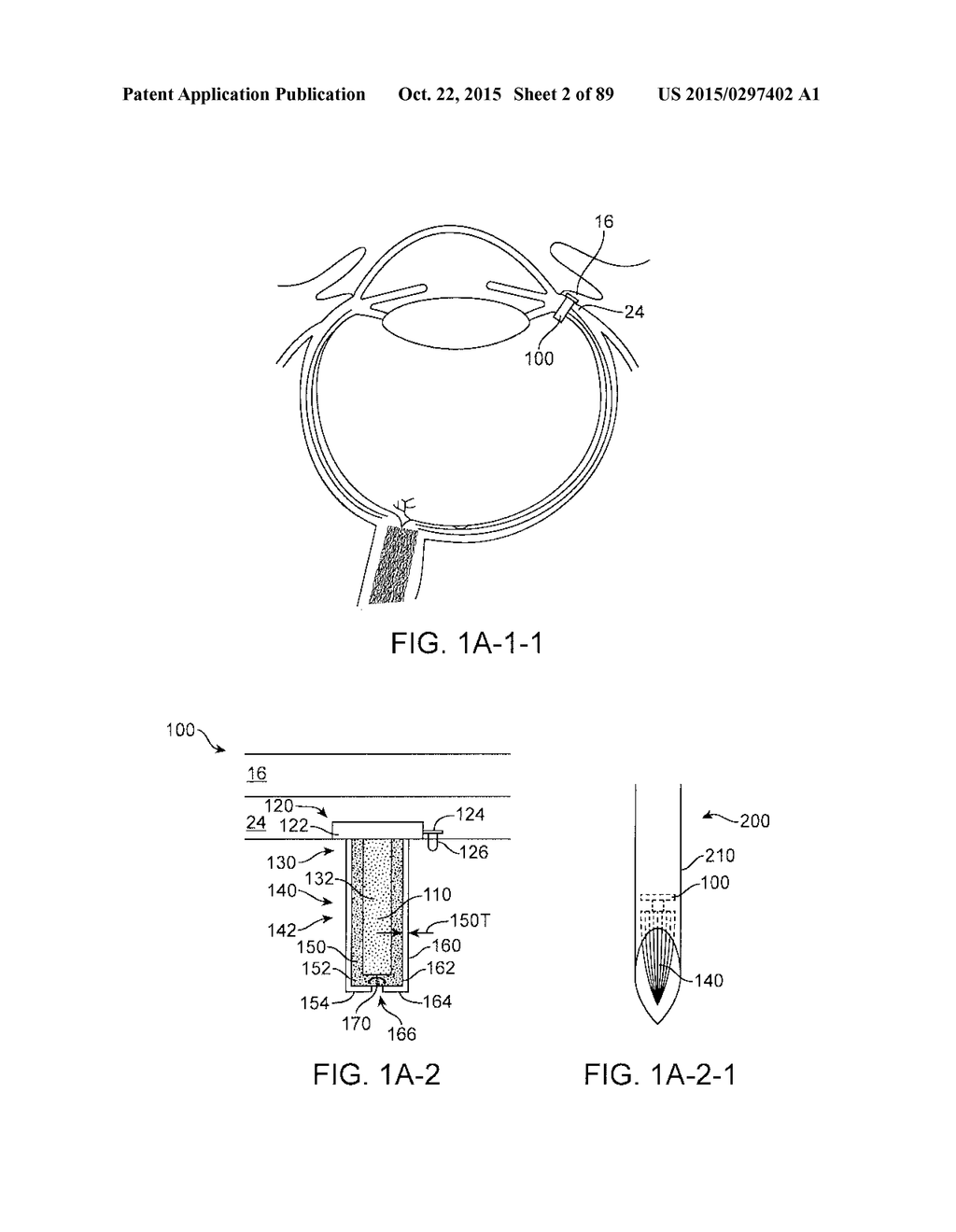 Implantable Therapeutic Device - diagram, schematic, and image 03