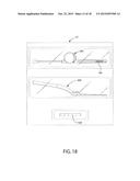 IMPLANTABLE DRUG DELIVERY COMPOSITIONS AND METHODS OF TREATMENT THEREOF diagram and image