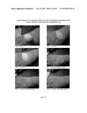 FOAMABLE FORMULATION diagram and image