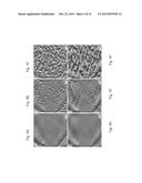 ORGANIC ACIDS AS AGENTS TO DISSOLVE CALCIUM MINERALS IN PATHOLOGICAL     CALCIFICATION AND USES THEREOF diagram and image