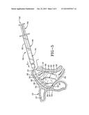 INTRANASAL MEDICATION DELIVERY DEVICE AND METHOD OF USE THEREOF diagram and image