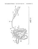 INTRANASAL MEDICATION DELIVERY DEVICE AND METHOD OF USE THEREOF diagram and image