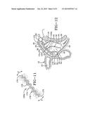 INTRANASAL MEDICATION DELIVERY DEVICE AND METHOD OF USE THEREOF diagram and image