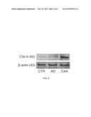 SUBSTANCES AND METHODS FOR THE TREATMENT OF CEREBRAL AMYLOID ANGIOPATHY     RELATED CONDITIONS OR DISEASE diagram and image