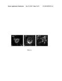 SUBSTANCES AND METHODS FOR THE TREATMENT OF CEREBRAL AMYLOID ANGIOPATHY     RELATED CONDITIONS OR DISEASE diagram and image